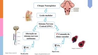 Choque Neurogênico
Lesão medular
Sistema Nervoso
Central (SNC)
Alteração no
sistema nervoso
autônomo
 Comando do
tônus vascular
 PA
 FC
Bradicardia
Hipotermia
Imagem: advogadouberlandia.com.br
Imagem: m.facebook.com
Imagem: thieme-connect.de
 