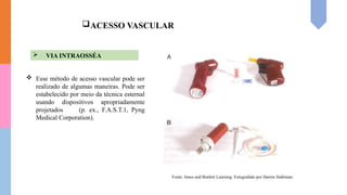 ACESSO VASCULAR
 VIA INTRAOSSÉA
Fonte: Jones and Bratlett Learning. Fotografado por Darren Stahlman.
 Esse método de acesso vascular pode ser
realizado de algumas maneiras. Pode ser
estabelecido por meio da técnica esternal
usando dispositivos apropriadamente
projetados (p. ex., F.A.S.T.1, Pyng
Medical Corporation).
 
