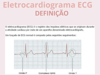 Eletrocardiograma ECG
 