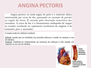 choque.pptx.pdf.......................................