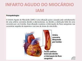 choque.pptx.pdf.......................................