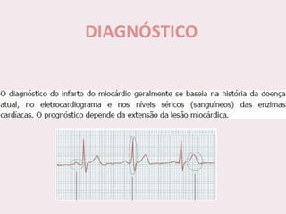 choque.pptx.pdf.......................................