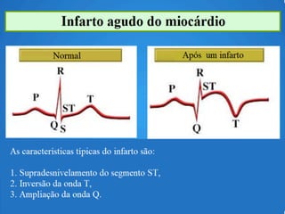 choque.pptx.pdf.......................................