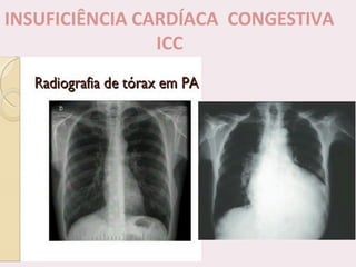 choque.pptx.pdf.......................................