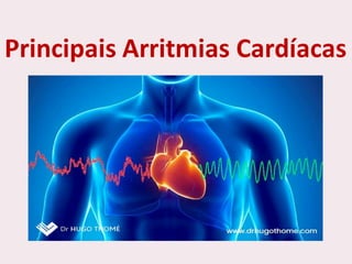 choque.pptx.pdf.......................................