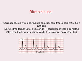 choque.pptx.pdf.......................................