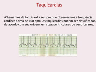 choque.pptx.pdf.......................................