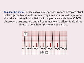 choque.pptx.pdf.......................................