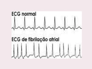 choque.pptx.pdf.......................................