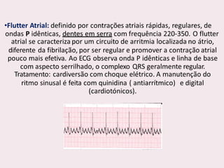 choque.pptx.pdf.......................................