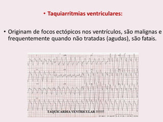 choque.pptx.pdf.......................................