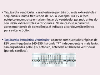 choque.pptx.pdf.......................................