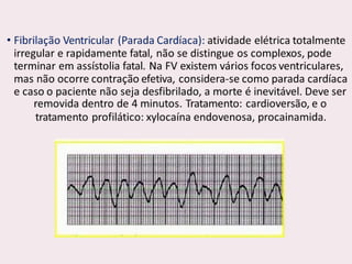 choque.pptx.pdf.......................................