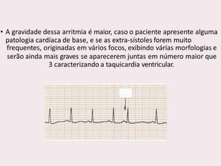 choque.pptx.pdf.......................................