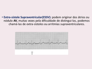 choque.pptx.pdf.......................................