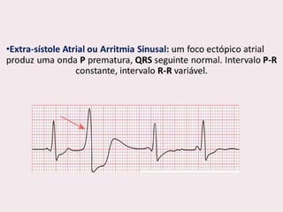 choque.pptx.pdf.......................................