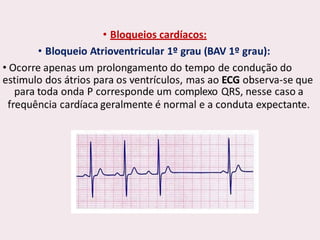 choque.pptx.pdf.......................................