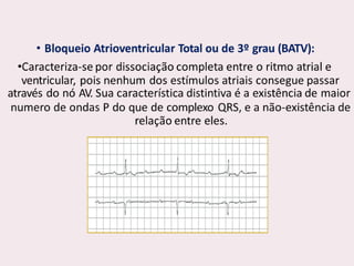 choque.pptx.pdf.......................................