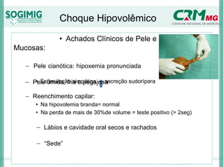 Choque Hipovolêmico
• Achados Clínicos de Pele e
Mucosas:
− Pele cianótica: hipoxemia pronunciada
− Pele úmida, fria e pegajosa
• Estimulação simpática secreção sudorípara
− Reenchimento capilar:
• Na hipovolemia branda= normal
• Na perda de mais de 30%de volume = teste positivo (> 2seg)
− Lábios e cavidade oral secos e rachados
− “Sede”
 