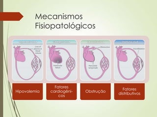Mecanismos
Fisiopatológicos

Hipovolemia

Fatores
cardiogênicos

Obstrução

Fatores
distributivos

 