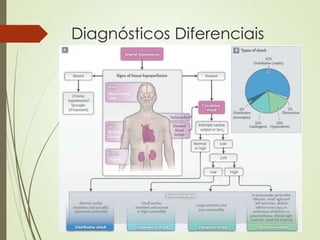 Diagnósticos Diferenciais

 