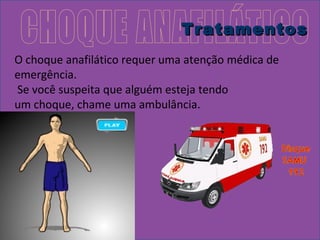 TTrraattaammeennttooss 
O choque anafilático requer uma atenção médica de 
emergência. 
Se você suspeita que alguém esteja tendo 
um choque, chame uma ambulância. 
 