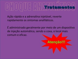 TTrraattaammeennttooss 
Ação rápida e a adrenalina injetável, reverte 
rapidamente os sintomas anafiláticos. 
É administrado geralmente por meio de um dispositivo 
de injeção automática, sendo a coxa, o local mais 
comum e eficaz. 
 