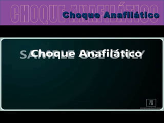 CChhooqquuee AAnnaaffiillááttiiccoo 
 