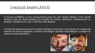CHOQUE ANAFILÁTICO
O choque anafilático é uma consequência grave de uma reação alérgica. Uma reação
alérgica pode ser desencadeada por picadas de insetos, alimentos, medicamentos ou
qualquer substância em que o indivíduo seja alérgico.
A histamina liberada durante os quadros alérgicos promovem uma reação em cadeia que
estimula de forma exagerada o sistema imunológico gerando vasodilatação e colapso do
sistema cardiorrespiratório.
 