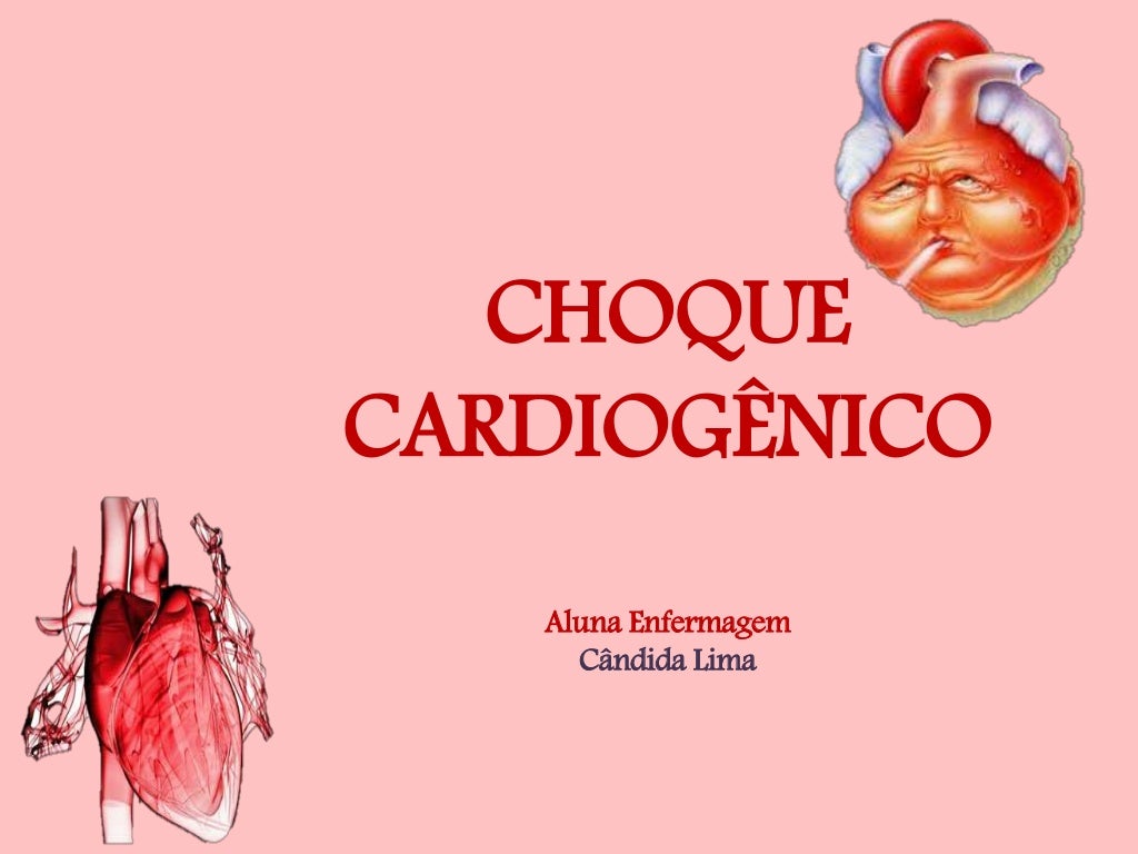 Choque cardiogênico