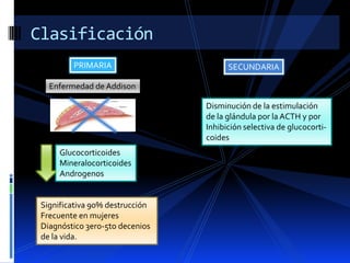 Clasificación
PRIMARIA

SECUNDARIA

Enfermedad de Addison
Disminución de la estimulación
de la glándula por la ACTH y por
Inhibición selectiva de glucocorticoides
Glucocorticoides
Mineralocorticoides
Androgenos

Significativa 90% destrucción
Frecuente en mujeres
Diagnóstico 3ero-5to decenios
de la vida.

 