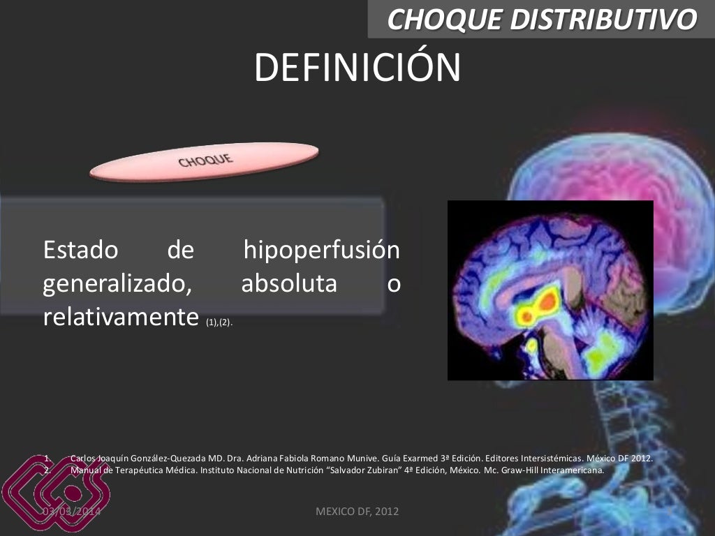 Choque distributivo