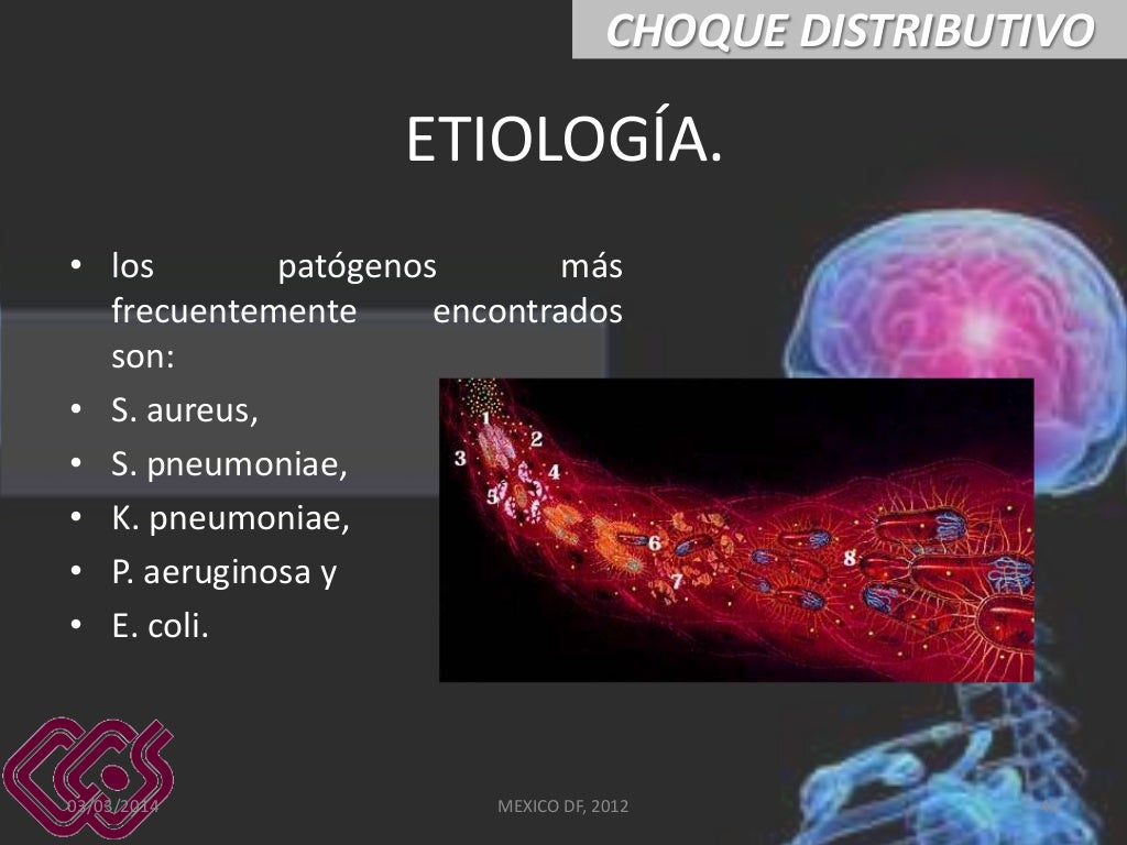 Choque distributivo