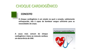 CHOQUE CARDIOGÊNICO
CONCEITO
O choque cardiogênico é um estado no qual o coração, subitamente
enfraquecido, não é capaz de bombear sangue suficiente para as
necessidades do corpo.
A causa mais comum do choque
cardiogênico é dano ao músculo cardíaco
em decorrência de IAM.
 