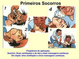 Primeiros Socorros
Freqüência de aplicação:
Sozinho: Duas ventilações e de dez a doze massagens cardíacas.
Em dupla: Uma ventilação e cinco massagens cardíacas.
 