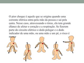 O pior choque é aquele que se origina quando uma 
corrente elétrica entra pela mão da pessoa e sai pela 
outra. Nesse caso, atravessando o tórax, ela tem grande 
chance • . 
de afetar o coração e a respiração. Se fizerem 
parte do circuito elétrico o dedo polegar e o dedo 
indicador de uma mão, ou uma mão e um pé, o risco é 
menor 
 