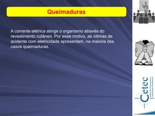 Queimaduras
A corrente elétrica atinge o organismo através do
revestimento cutâneo. Por esse motivo, as vitimas de
acidente com eletricidade apresentam, na maioria dos
casos queimaduras.
 