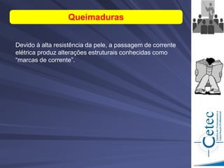 Devido à alta resistência da pele, a passagem de corrente
elétrica produz alterações estruturais conhecidas como
“marcas de corrente”.
Queimaduras
 
