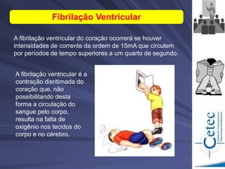 A fibrilação ventricular do coração ocorrerá se houver
intensidades de corrente da ordem de 15mA que circulem
por períodos de tempo superiores a um quarto de segundo.
Fibrilação Ventricular
A fibrilação ventricular é a
contração disritimada do
coração que, não
possibilitando desta
forma a circulação do
sangue pelo corpo,
resulta na falta de
oxigênio nos tecidos do
corpo e no cérebro.
 