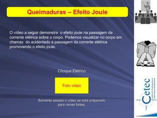 Choque Elétrico
Somente assista o vídeo se está preparado
para cenas fortes.
Queimaduras – Efeito Joule
O vídeo a seguir demonstra o efeito joule na passagem da
corrente elétrica sobre o corpo. Podemos visualizar no corpo em
chamas do acidentado a passagem da corrente elétrica
promovendo o efeito joule.
Foto vídeo
 