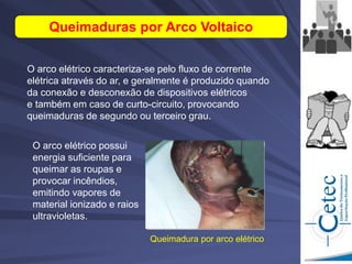 O arco elétrico caracteriza-se pelo fluxo de corrente
elétrica através do ar, e geralmente é produzido quando
da conexão e desconexão de dispositivos elétricos
e também em caso de curto-circuito, provocando
queimaduras de segundo ou terceiro grau.
Queimaduras por Arco Voltaico
Queimadura por arco elétrico
O arco elétrico possui
energia suficiente para
queimar as roupas e
provocar incêndios,
emitindo vapores de
material ionizado e raios
ultravioletas.
 