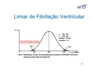 Limiar de Fibrilação Ventricular 
1122 
 