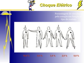 Choque El trico E Seus Efeitos PPT choque-el-trico-e-seus-efeitos-ppt