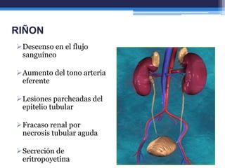 RIÑON
Descenso en el flujo
 sanguíneo

Aumento del tono arteria
 eferente

Lesiones parcheadas del
 epitelio tubular

Fracaso renal por
 necrosis tubular aguda

Secreción de
 eritropoyetina
 
