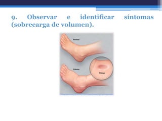 9.   Observar    e  identificar   síntomas
(sobrecarga de volumen).
 