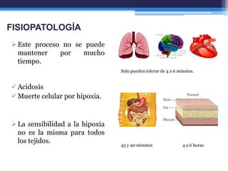 FISIOPATOLOGÍA
 Este proceso no se puede
  mantener    por   mucho
  tiempo.
                                 Solo pueden tolerar de 4 a 6 minutos.


 Acidosis
 Muerte celular por hipoxia.



 La sensibilidad a la hipoxia
  no es la misma para todos
  los tejidos.
                                 45 y 90 minutos                4 a 6 horas
 