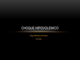 Angie Montalvo Chumbe
VII ciclo
CHOQUE HIPOVOLEMICO
 