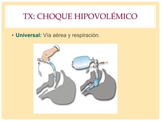 TX: CHOQUE HIPOVOLÉMICO
• Universal: Vía aérea y respiración.
 