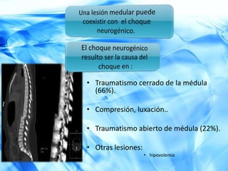 CUADRO CLÍNICOHipertensión.Presión de pulso aumentado.TaquicardiaRespuesta inicial( 2-3min)Respuesta Tardía(1-3 semanas)Hipotensión.