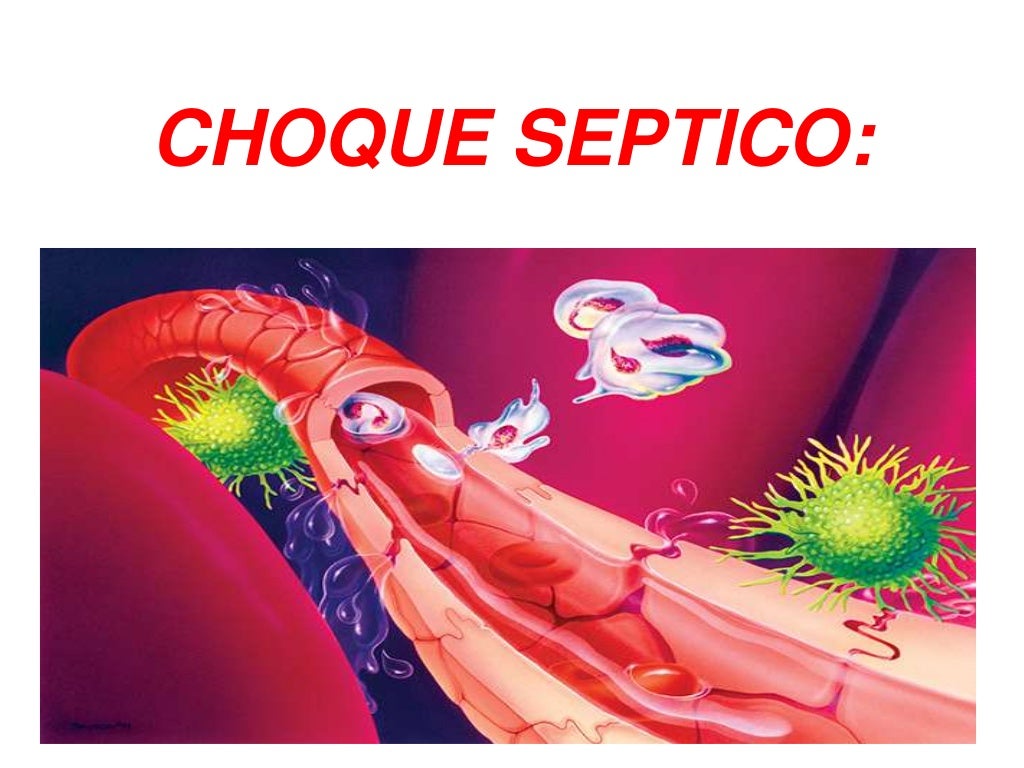 Choque septico